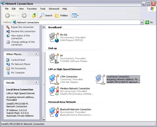 Windows XP : Network Connections - Local Area Connection - Acquiring network address Windows XP : Network Connections - Local Area Connection - Acquiring network address